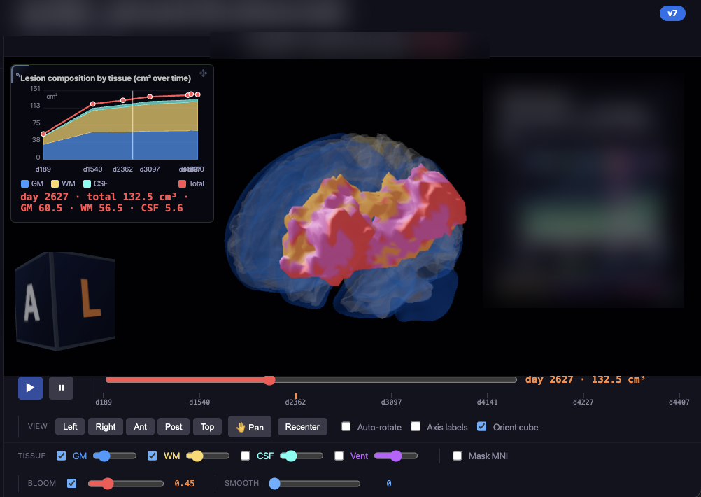Interactive lesion browser showing 3D lesion growth over time with a session timeline